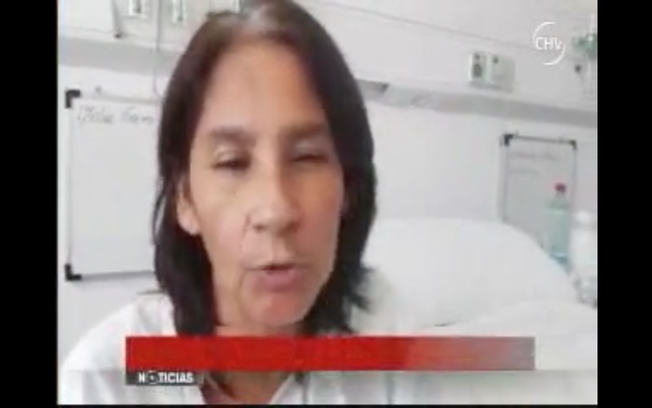 El Doctor Torres se refiere a la quemada por fuga de gas en noticiario de Chilevisión, Dr. Esteban Torres