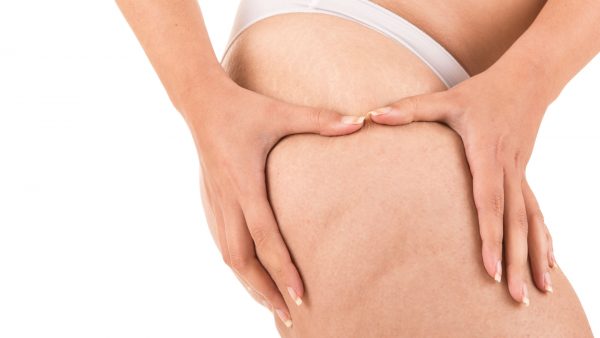 Dr. Esteban Torres discutiendo mitos y realidades de la celulitis en el programa "Bebé al Día".