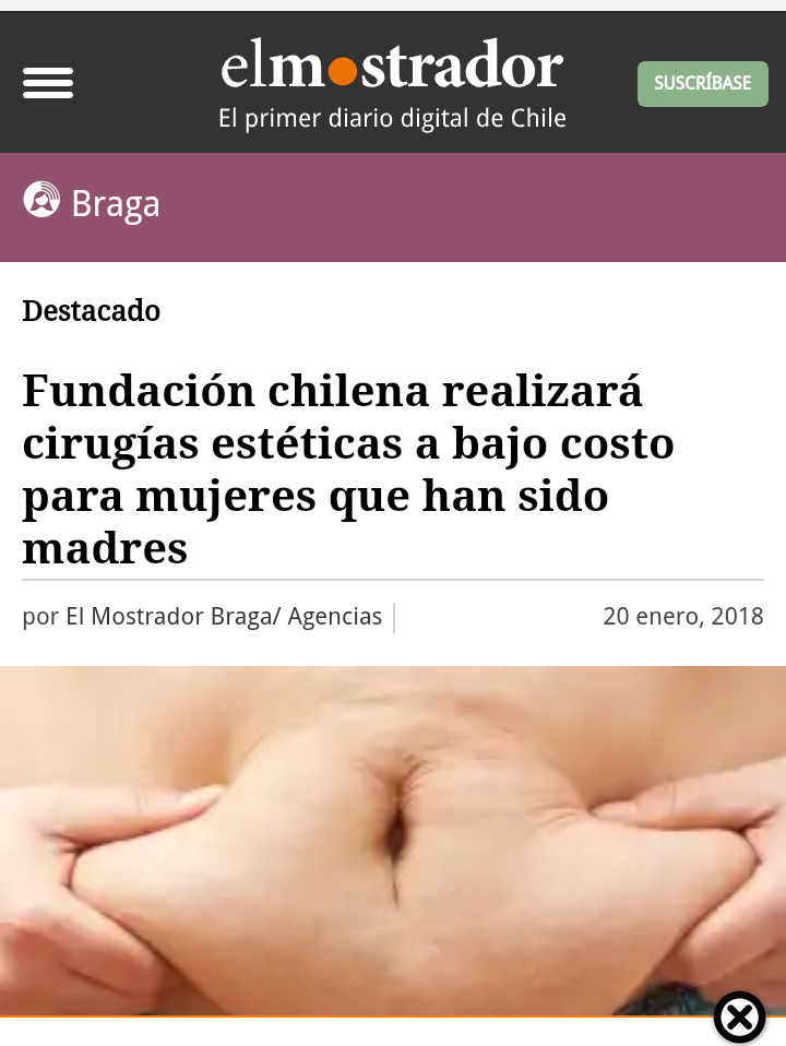 Dr. Esteban Torres, cirujano plástico en Santiago, destacado en El Mostrador por su labor en Fundación Mujer 2.0.