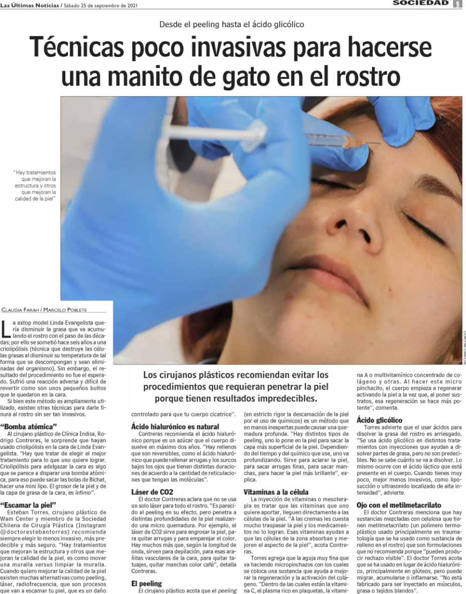 Técnicas poco invasivas para hacerse una manito de gato en el rostro, Dr. Esteban Torres