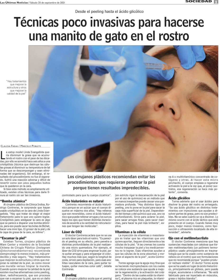 Técnicas poco invasivas para hacerse una manito de gato en el rostro - Dr. Esteban Torres Cirujano Plástico Acreditado