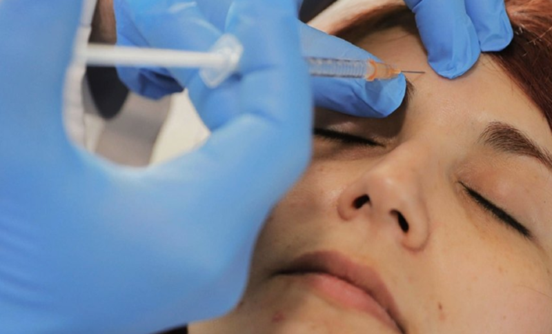 Dr. Esteban Torres | Innovadoras técnicas poco invasivas para rejuvenecer el rostro en Santiago.